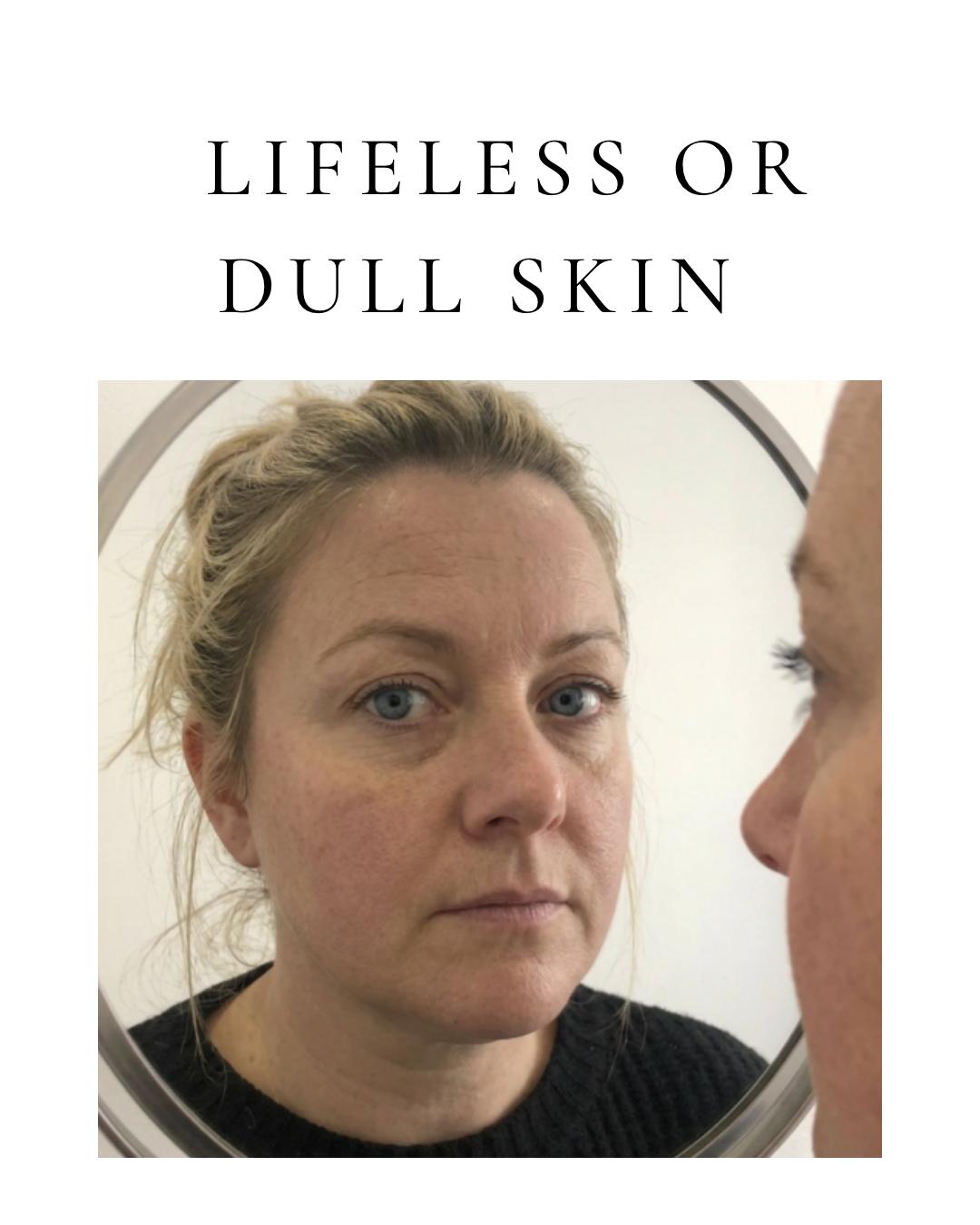 Dull Lifeless Skin